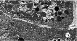 Image of Carcinonemertes epialti Coe 1902