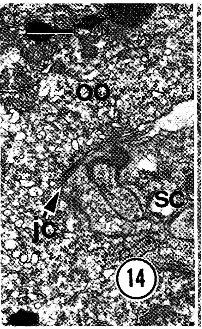 Image of Carcinonemertes epialti Coe 1902