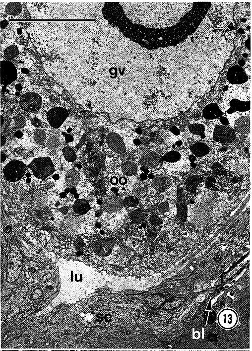 Image of Carcinonemertes epialti Coe 1902