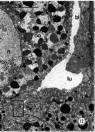 Image of Carcinonemertes epialti Coe 1902