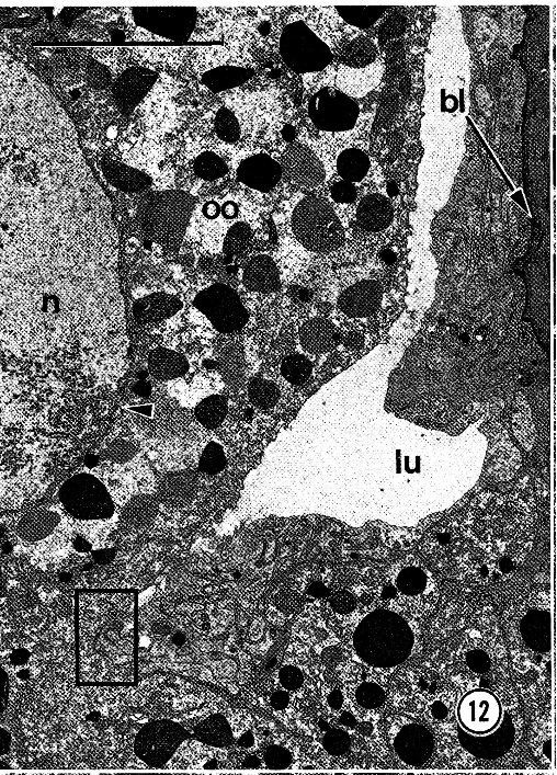 Image of Carcinonemertes epialti Coe 1902