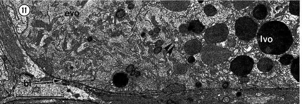 Image of Carcinonemertes epialti Coe 1902