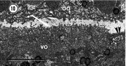 Image of Carcinonemertes epialti Coe 1902