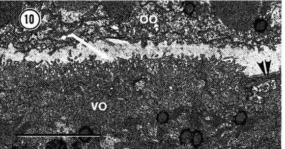 Image of Carcinonemertes epialti Coe 1902