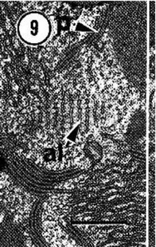 Image of Carcinonemertes epialti Coe 1902