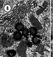 Image of Carcinonemertes epialti Coe 1902