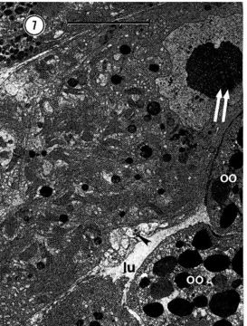 Image of Carcinonemertes epialti Coe 1902