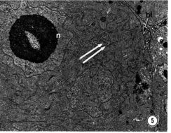 Image of Carcinonemertes epialti Coe 1902