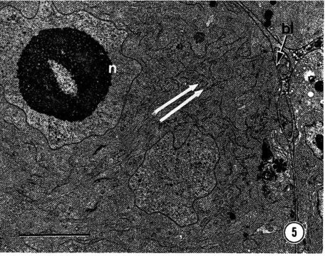 Image of Carcinonemertes epialti Coe 1902