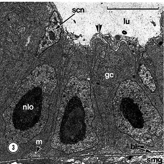 Image of Carcinonemertes epialti Coe 1902