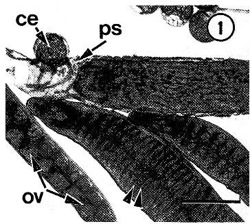 Image of Carcinonemertes epialti Coe 1902