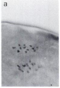 Image of Carcinonemertes epialti Coe 1902