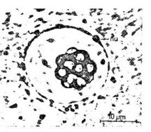 Image of Ototyphlonemertes (Macintoshi) americana Gerner 1969