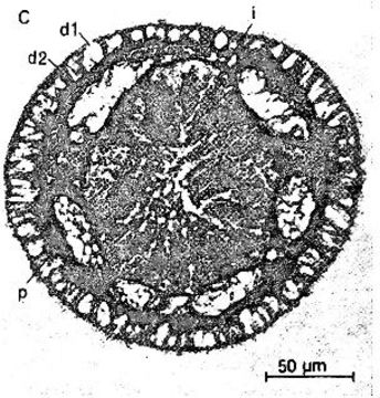 Image of Ototyphlonemertes (Macintoshi) americana Gerner 1969