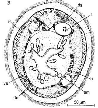 Image of Ototyphlonemertes (Macintoshi) americana Gerner 1969