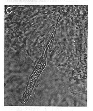 Image of Ototyphlonemertes (Macintoshi) americana Gerner 1969