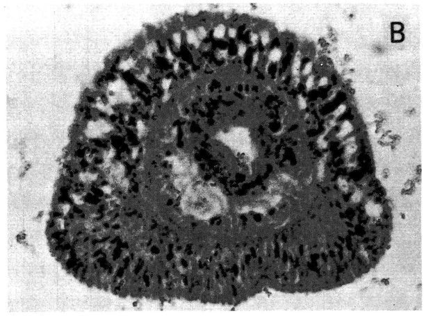 Image of Ototyphlonemertes (Macintoshi) americana Gerner 1969