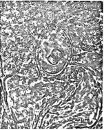 Image of Ototyphlonemertes aurantiaca (du Plessis 1891)