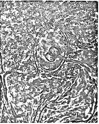 Image of Ototyphlonemertes aurantiaca (du Plessis 1891)