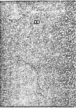 Image of Ototyphlonemertes aurantiaca (du Plessis 1891)