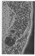 Image of Ototyphlonemertes cirrula Mock & Schmidt 1975