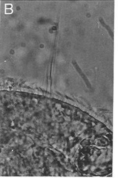 Image of Ototyphlonemertes cirrula Mock & Schmidt 1975