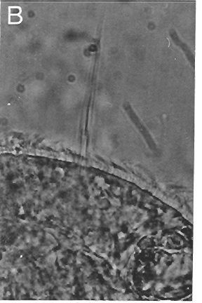 Image of Ototyphlonemertes cirrula Mock & Schmidt 1975