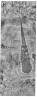 Image of Ototyphlonemertes cirrula Mock & Schmidt 1975