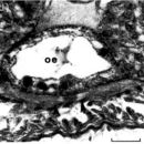 Image of Ototyphlonemertes (Duplex) correae Envall 1996