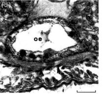 Image of Ototyphlonemertes (Duplex) correae Envall 1996