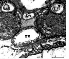 Image of Ototyphlonemertes (Duplex) correae Envall 1996