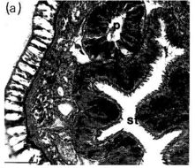 Image of Ototyphlonemertes (Duplex) correae Envall 1996