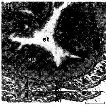 Image of Ototyphlonemertes (Duplex) correae Envall 1996