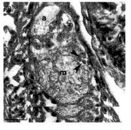 Image of Ototyphlonemertes (Duplex) correae Envall 1996