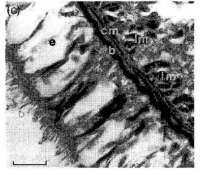 Image of Ototyphlonemertes (Duplex) correae Envall 1996