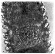 Image of Ototyphlonemertes
