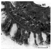 Image of Ototyphlonemertes