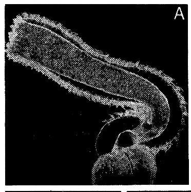 Image de Ototyphlonemertes pallida (Keferstein 1862)