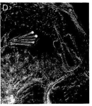 Image of Ototyphlonemertes pallida (Keferstein 1862)