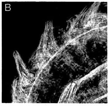 Image de Ototyphlonemertes pallida (Keferstein 1862)