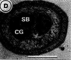 Image of Carcinonemertes australiensis Campbell, Gibson & Evans 1989