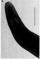 Image of Carcinonemertes australiensis Campbell, Gibson & Evans 1989