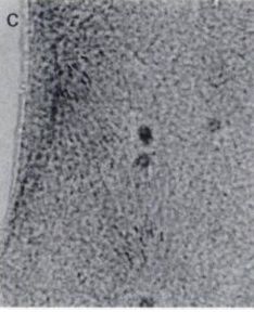 Image of Carcinonemertes errans Wickham 1978