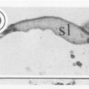 Sivun Carcinonemertes humesi Gibson & Jones 1990 kuva