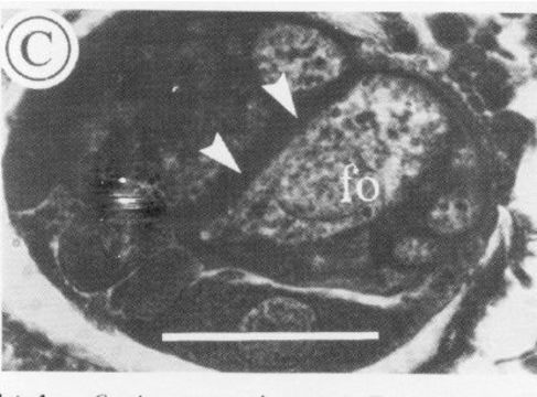 Image of Carcinonemertes humesi Gibson & Jones 1990