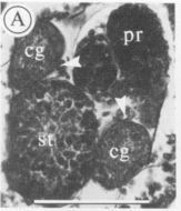 Image of Carcinonemertes humesi Gibson & Jones 1990