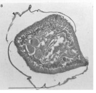 Image of Carcinonemertes pinnotheridophila McDermott & Gibson 1993