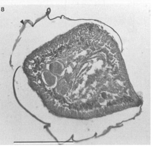 Image of Carcinonemertes pinnotheridophila McDermott & Gibson 1993