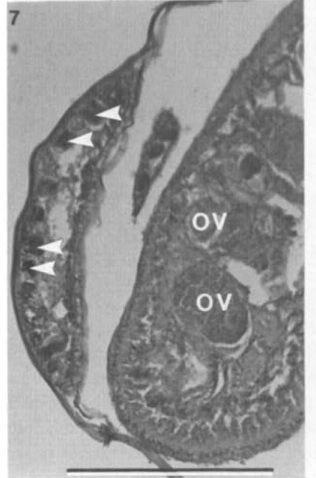 Image of Carcinonemertes pinnotheridophila McDermott & Gibson 1993