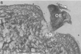 Image of Carcinonemertes pinnotheridophila McDermott & Gibson 1993